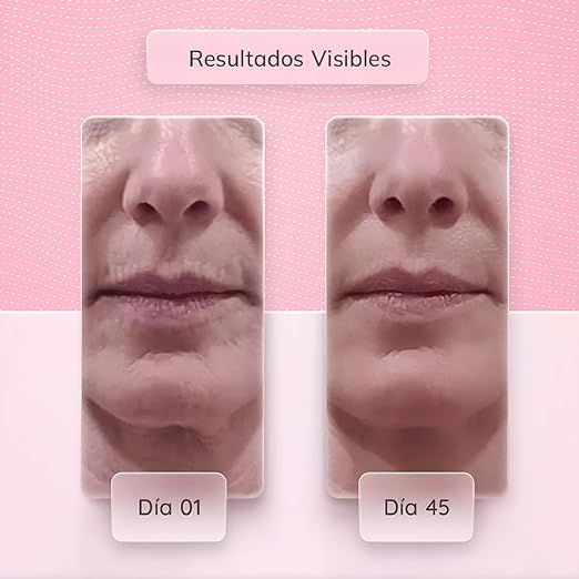 Masajeador Facial Con Microcorriente