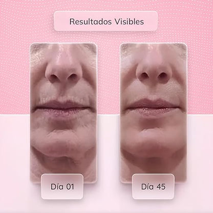 Masajeador Facial Con Microcorriente